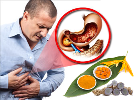 cây thuốc nam chữa bệnh dạ dày